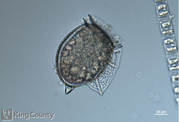 Photo of Dinophysis odiosa